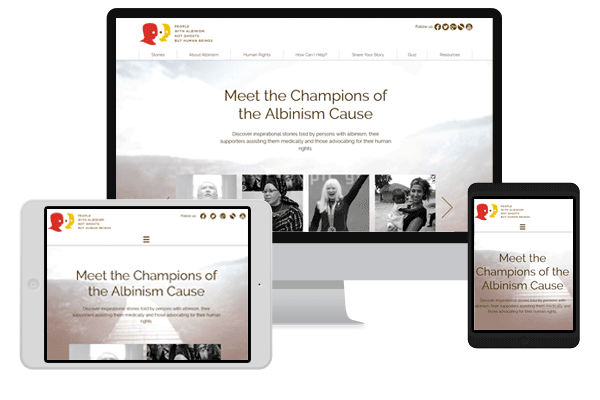 People with albinism